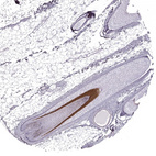 Anti-KRT74 Antibody