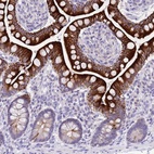 Anti-R3HDM4 Antibody