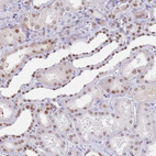 Anti-HMGN1 Antibody