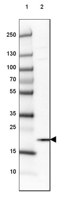 Anti-HMGN1 Antibody