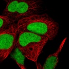 Anti-HMGN1 Antibody