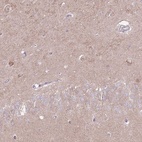 Anti-LRFN3 Antibody