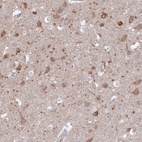 Immunohistochemical staining of human cerebral cortex shows high expression.