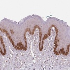 Anti-TUB Antibody