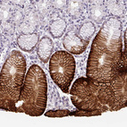 Anti-SLC5A5 Antibody