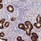 Anti-SLC5A5 Antibody