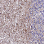 Anti-SAMD1 Antibody