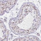 Anti-SAMD1 Antibody