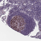 Anti-SAMD1 Antibody