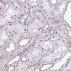 Anti-INO80C Antibody