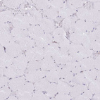 Anti-INO80C Antibody