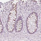 Anti-NXPE1 Antibody