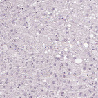 Anti-NXPE1 Antibody