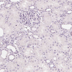 Anti-NXPE1 Antibody