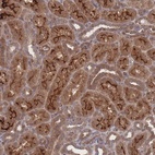 Anti-NBEAL1 Antibody