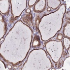 Anti-OR52I2 Antibody