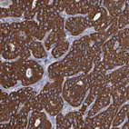 Anti-IDH3B Antibody