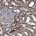 Anti-IDH3B Antibody