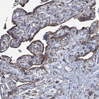 Anti-IDH3B Antibody