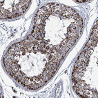 Anti-IDH3B Antibody