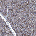 Anti-IDH3B Antibody