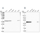 Anti-IDH3B Antibody