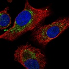 Anti-IDH3B Antibody