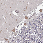 Anti-HYAL3 Antibody