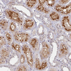 Anti-HYAL3 Antibody