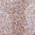 Anti-KRT71 Antibody