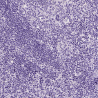 Anti-KRT71 Antibody