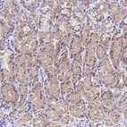 Anti-SPIRE2 Antibody