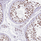 Immunohistochemical staining of human testis shows strong nuclear positivity in cells in seminiferous ducts and leydig cells.