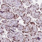 Immunohistochemical staining of human placenta shows strong nuclear positivity in trophoblastic cells.