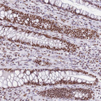 Immunohistochemical staining of human rectum shows strong nuclear positivity in glandular cells.