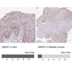 Anti-UBXN7 Antibody