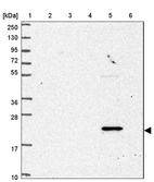 Anti-NBEAL1 Antibody