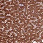 Anti-COQ5 Antibody