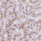 Anti-CASC4 Antibody