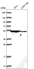 Anti-DYNC1LI2 Antibody