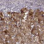 Anti-PCSK2 Antibody