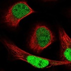 Anti-NCAPG2 Antibody