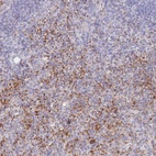 Anti-PTGDR Antibody