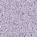 Anti-PTGDR Antibody