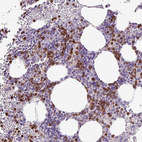 Anti-HTR3E Antibody