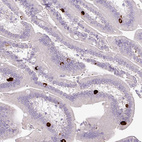 Anti-HTR3E Antibody