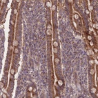 Anti-SLC35B4 Antibody