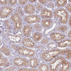 Anti-NTN4 Antibody