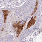 Anti-NTN4 Antibody