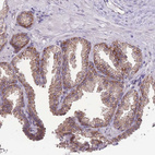 Immunohistochemical staining of human prostate shows moderate cytoplasmic positivity in glandular cells.